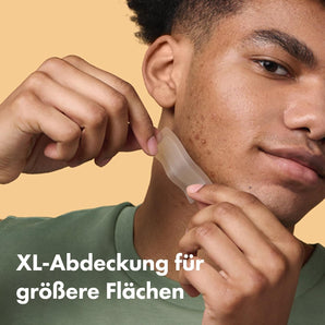 [RESIGILAT] Plasturi XL Mighty Patch Surface pentru acnee, 10 bucati.